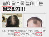 탈모 치료·예방 '온라인 과대광고' 무더기 적발
