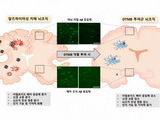 포항공대 연구팀, 당뇨잡는 단백질로 치매 치료법 개발