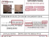 마이크로니들 화장품 ‘허위·과대광고’ 82건 적발