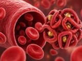“뇌가 숨이 막힌다”…빈혈, 치매 스위치 될 수 있다
