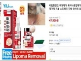 '쥐젖 제거' 불법 인터넷 유통·판매 569건 적발